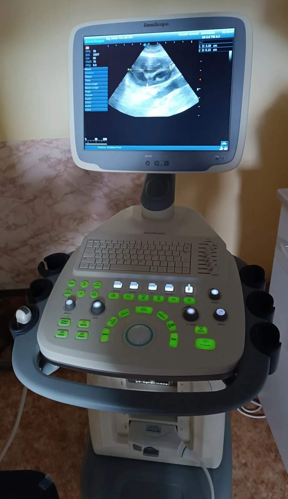 Diagnostický ultrazvuk